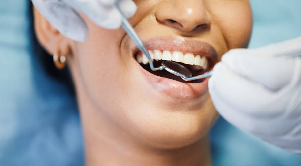 Best Emergency Dentist for Knocked-Out Tooth in North Merrick, NY