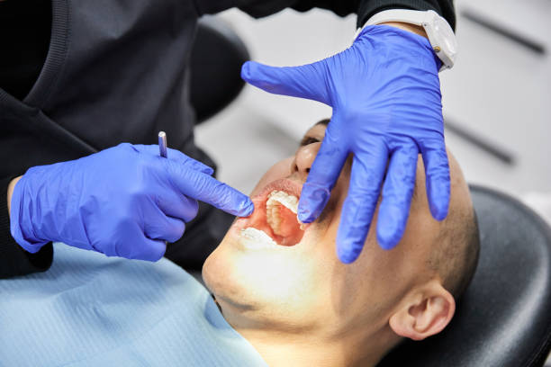 Best Emergency Dental Extractions in North Merrick, NY